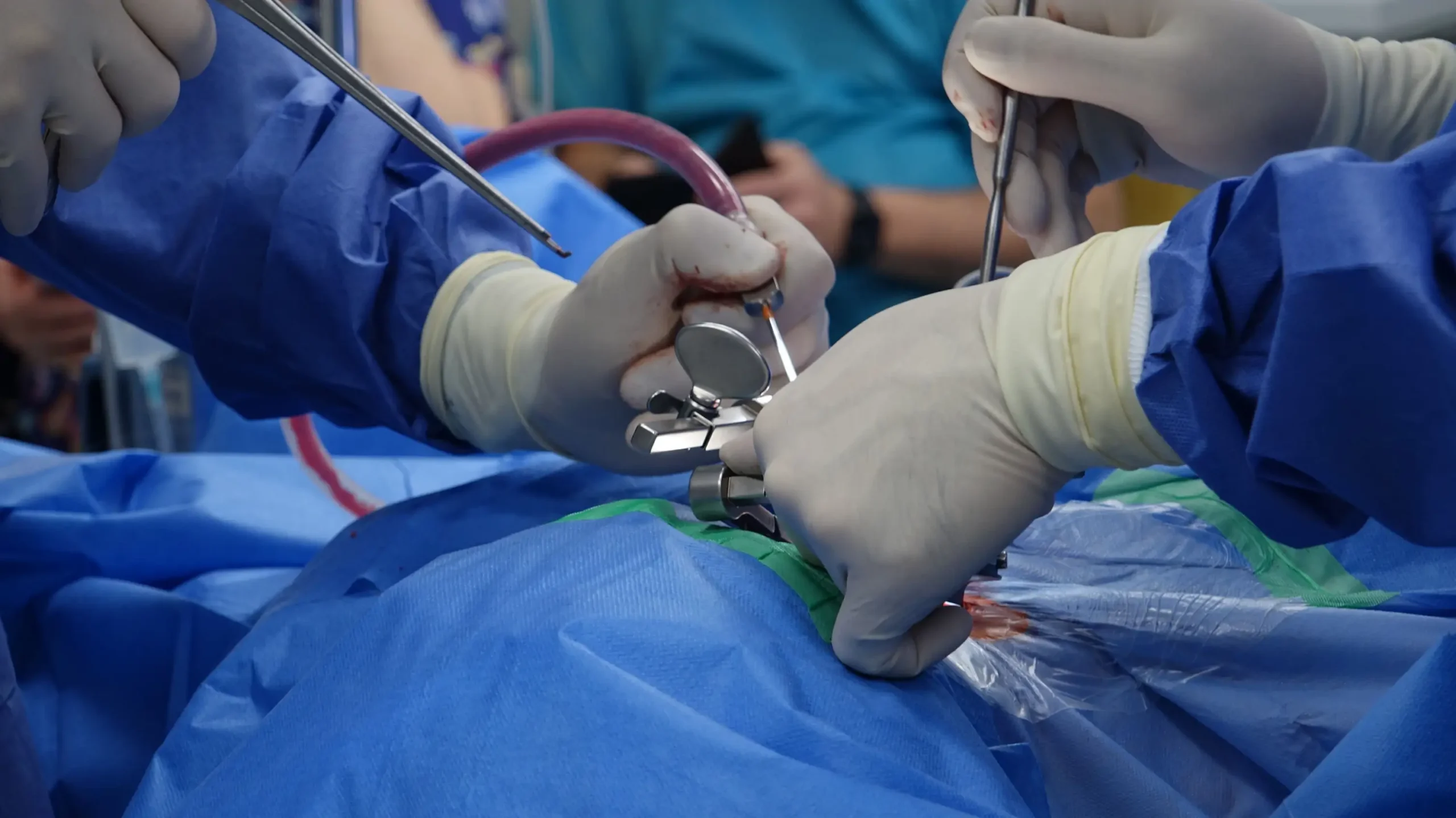 Cardiothoracic Surgery in Egypt